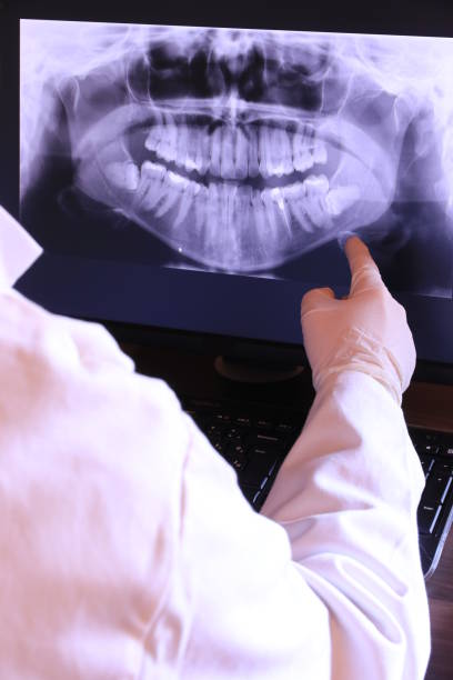 Best Emergency Tooth Extraction in Hightstown, NJ
