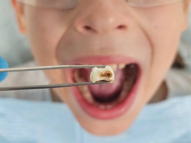 Best Emergency Treatment for Toothache in Hightstown, NJ